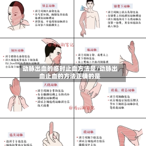 动脉出血的临时止血方法是/动脉出血止血的方法正确的是-第2张图片