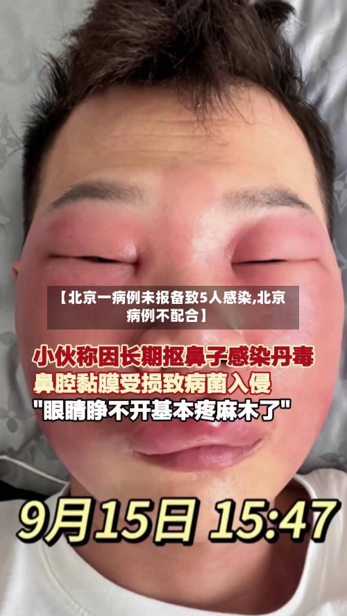【北京一病例未报备致5人感染,北京病例不配合】