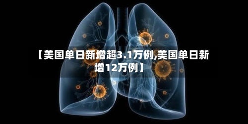【美国单日新增超3.1万例,美国单日新增12万例】-第2张图片